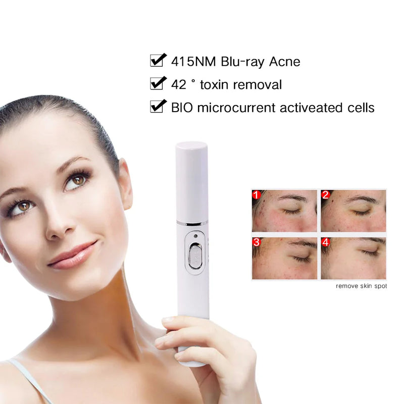 Caneta laser para remoção de rugas e acne, remoção de manchas de pele, anti-varicosas, tratamento de veias de aranha, luz azul médica, máquina facial